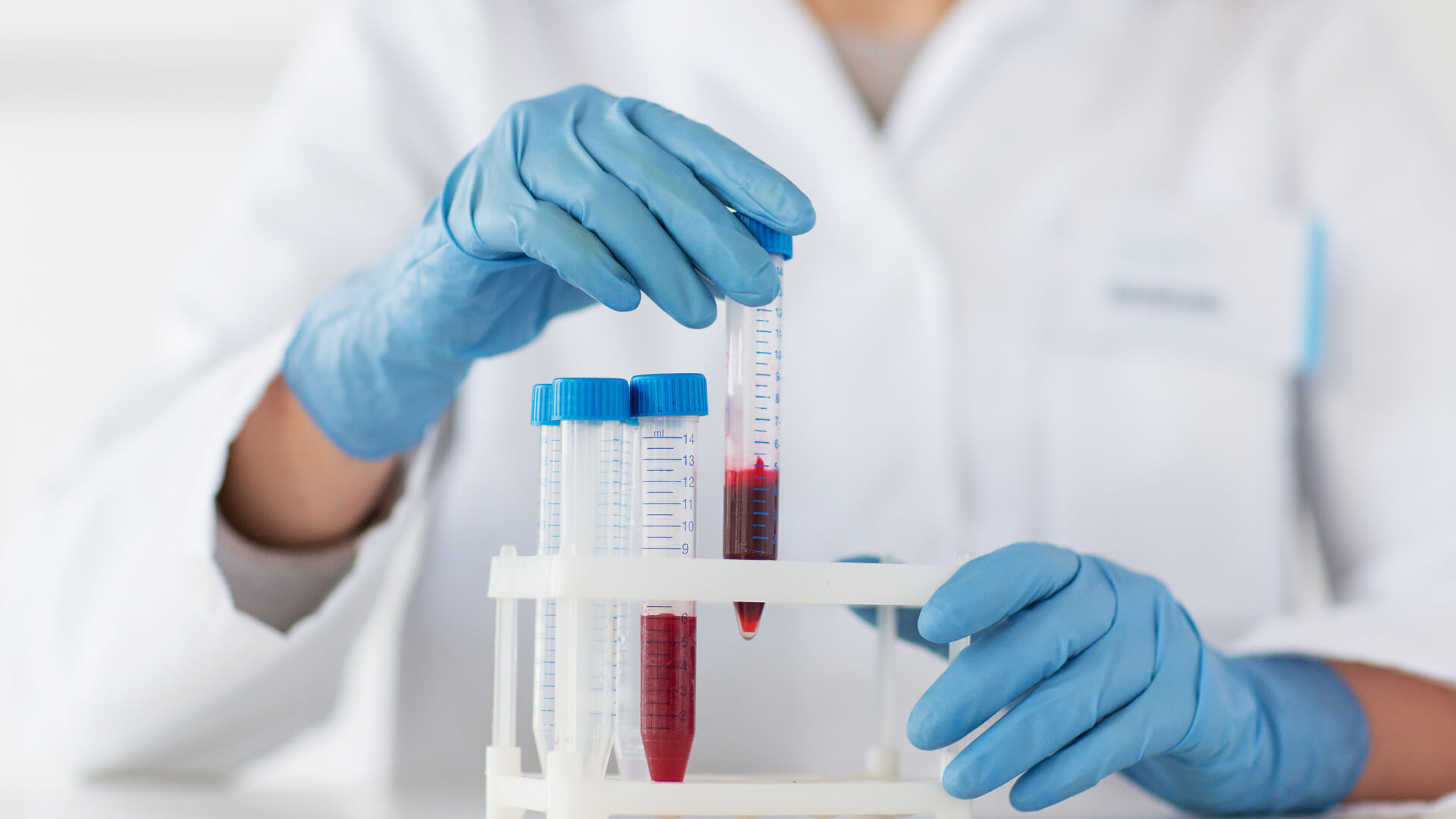 Blood Vials Image