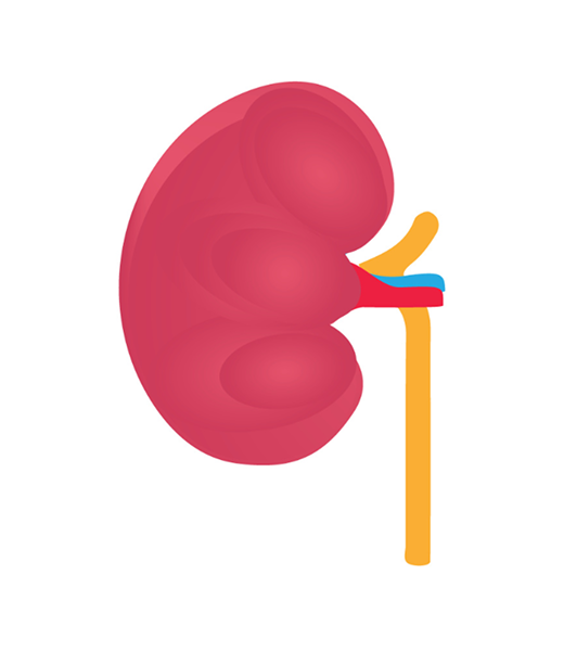 Kidney Stage 1 Image Kidney Stage 1 Image