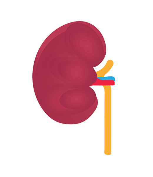 Kidney Stage 2 Image Kidney Stage 2 Image