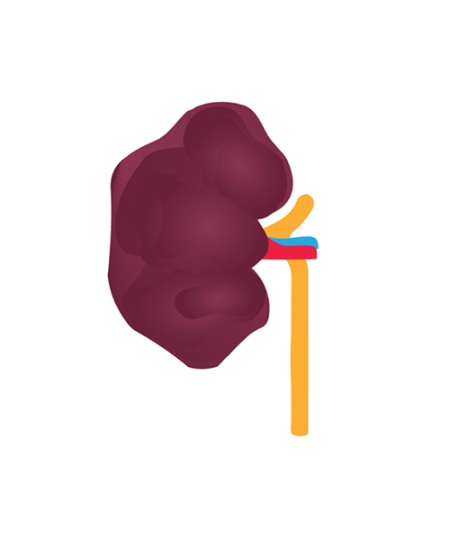 Kidney Stage 5 Image Kidney Stage 5 Image